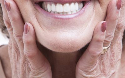 Teeth Whitening and Dentures?