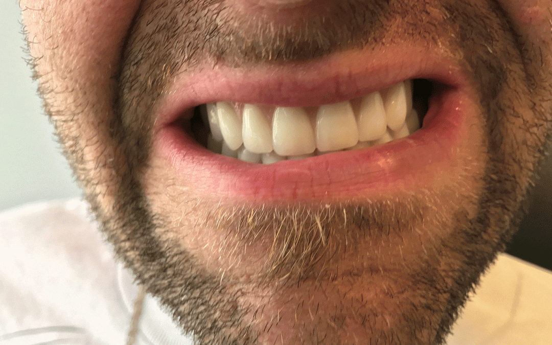 Why You Should Choose Woodside Denture Centre