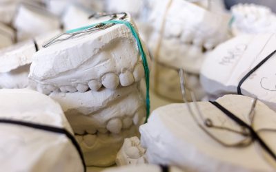 THE PROCESS OF MAKING YOUR DENTURES in Airdrie Alberta