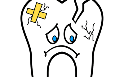 3 Common Reasons for Needing Dentures