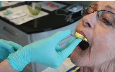New to Dentures – Short Overview of your Options