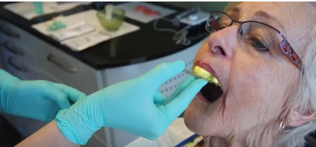 New to Dentures – Short Overview of your Options