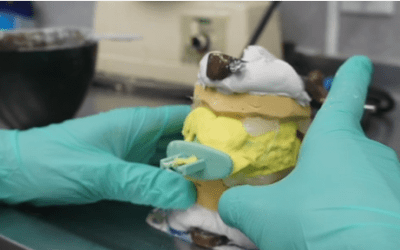 Dentures OnSite Labs vs Offsite Services