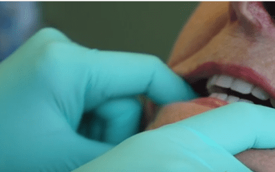 What are Denture Relines?