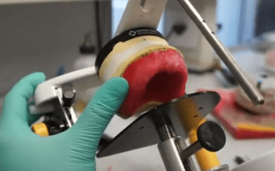 How Long Do Dentures Take to Make