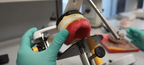 How Dentures are Made – A Step by Step Visual - Woodside Denture Centre