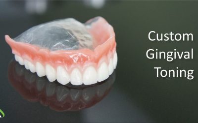 Aesthetics Dentures Option – Gingival Toning and Clear Acrylic