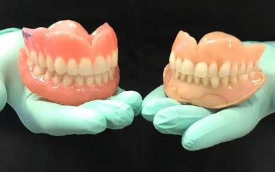 Why dentures take so long to make?