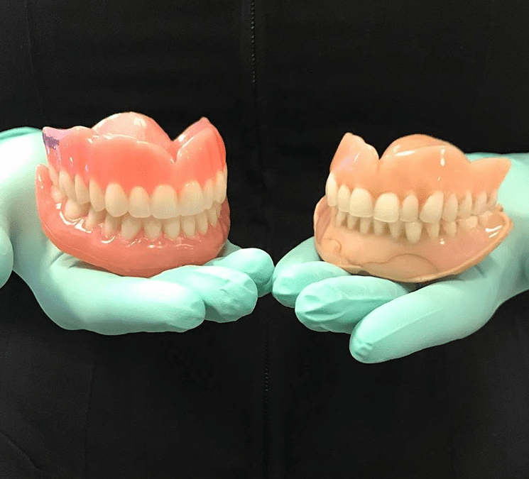 Why dentures take so long to make?