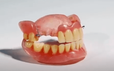 Common Reasons for Denture Repair & Consequences of Neglecting it
