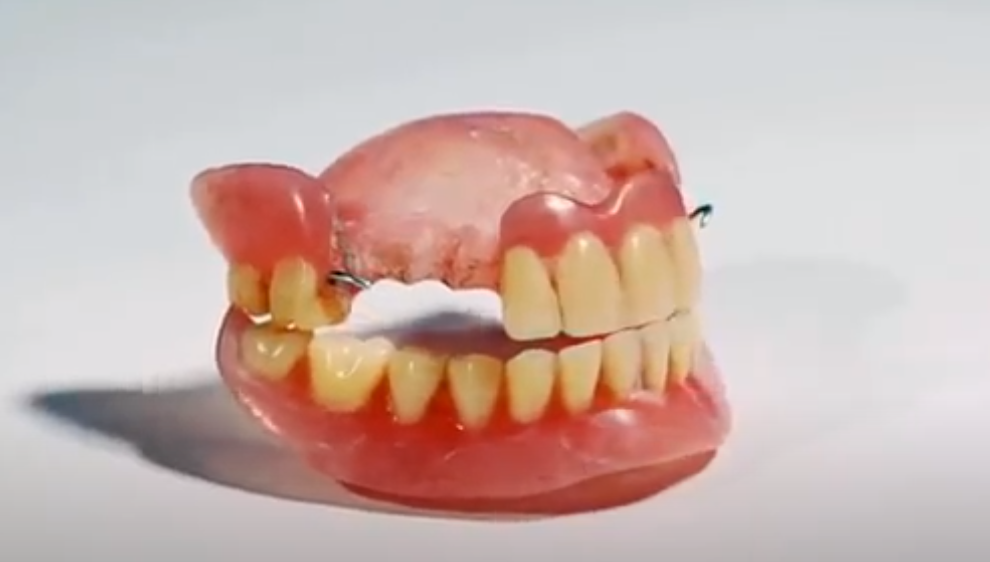 Common Reasons for Denture Repair & Consequences of Neglecting it