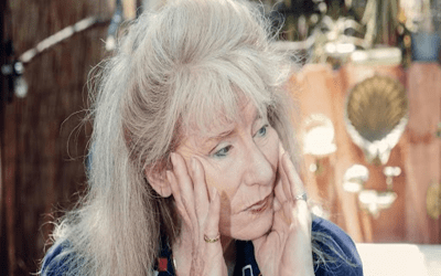 Signs You May Need Dentures (Before Symptoms Become Severe)