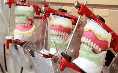 Emergency Denture Repair & Same-Day Services in Airdrie Alberta: Why Quick Action Matters