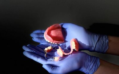 Why Dentures Become Loose (And How to Fix Them)