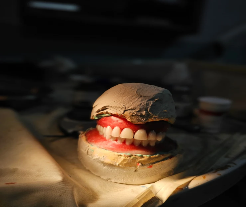 dentures alberta